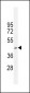 CRFR1 Antibody (Q103)